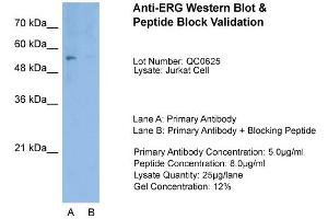 Host:  Rabbit  Target Name:  ERG  Sample Type:  Jurkat  Lane A:  Primary Antibody  Lane B:  Primary Antibody + Blocking Peptide  Primary Antibody Concentration:  1. (ERG antibody  (Middle Region))