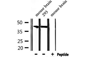Western Blotting (WB) image for anti-Chromobox Homolog 6 (CBX6) (N-Term) antibody (ABIN6260521)