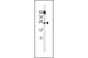 C Antibody (N-term) (ABIN656853 and ABIN2846058) western blot analysis in mouse testis tissue lysates (35 μg/lane). (CT011 Protein antibody  (N-Term))
