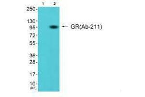 Western blot analysis of extracts from K562 cells (Lane 2), using GR (Ab-211) antiobdy. (Glucocorticoid Receptor antibody  (Ser211))