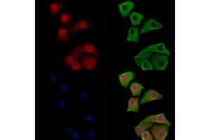 Phospho-JIP1 (Thr103) Antibody staining Hela cells(heat shock treatment) by IF/ICC.