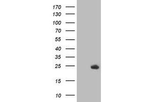 HEK293T cells were transfected with the pCMV6-ENTRY control (Left lane) or pCMV6-ENTRY DTYMK (Right lane) cDNA for 48 hrs and lysed. (DTYMK antibody)