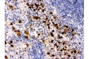 Anti- S100A9 Picoband antibody, IHC(P) IHC(P): Mouse Spleen Tissue (S100A9 antibody  (AA 2-113))