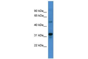 WB Suggested Anti-TMEM176B Antibody Titration:  0.