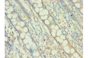 Immunohistochemistry (IHC) image for anti-BCL2-Associated Athanogene 5 (BAG5) (AA 198-447) antibody (ABIN7145226)