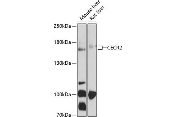 CECR2 antibody  (AA 170-370)