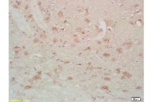 Formalin-fixed and paraffin embedded rat brain labeled with Anti-FABPB Polyclonal Antibody, Unconjugated (ABIN677888) at 1:200, followed by conjugation to the secondary antibody and DAB staining (FABP7 antibody  (AA 1-100))