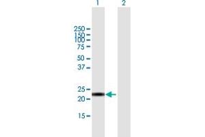 Western Blot analysis of CALML6 expression in transfected 293T cell line by CALML6 MaxPab polyclonal antibody. (CALML6 antibody  (AA 1-181))