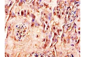 Immunohistochemistry of paraffin-embedded human placenta tissue using ABIN7175388 at dilution of 1:100 (FLT4 antibody  (AA 1112-1329))