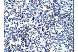 Image no. 2 for anti-Glial Cells Missing Homolog 1 (GCM1) (N-Term) antibody (ABIN6735857) (GCM1 antibody  (N-Term))