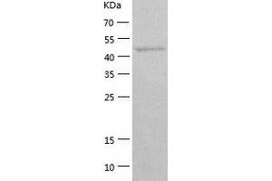Western Blotting (WB) image for delta Like Protein 3 (DLL3) (AA 27-492) protein (His-IF2DI Tag) (ABIN7122628)