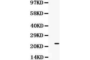 Observed bind size: 23KD (SECTM1 antibody  (C-Term))