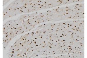 Immunohistochemistry (IHC) image for anti-Small Nuclear RNA Activating Complex, Polypeptide 4, 190kDa (SNAPC4) (N-Term) antibody (ABIN6257508)