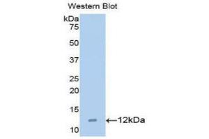 Western Blotting (WB) image for anti-Chemokine (C-C Motif) Ligand 15 (CCL15) (AA 22-113) antibody (ABIN1173091) (CCL15 antibody  (AA 22-113))