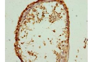 Immunohistochemistry of paraffin-embedded human testis tissue using ABIN7147043 at dilution of 1:100 (M6PR antibody  (AA 1-277))