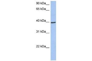 ACADM antibody used at 1 ug/ml to detect target protein. (Medium-Chain Specific Acyl-CoA Dehydrogenase, Mitochondrial (N-Term) antibody)
