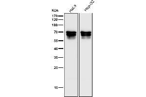 All lanes use the Antibody at 1:3K dilution for 1 hour at room temperature.