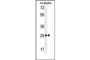 Western blot analysis of PGAM2 Antibody (N-term) in mouse testis tissue lysates (35ug/lane). (PGAM2 antibody  (N-Term))