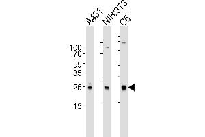 Western blot analysis of lysates from A431, mouse NIH/3T3, rat C6 cell line (from left to right), using RAC1 Antibody (ABIN6242819 and ABIN6577074). (RAC1 antibody)