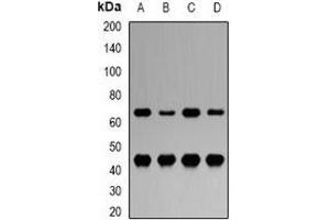 Western blot analysis of LRH-1 expression in MCF7 (A), Hela (B), mouse liver (C), rat liver (D) whole cell lysates.