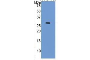 WB of Protein Standard: different control antibodies  against Highly purified E. (TNNI3 ELISA Kit)