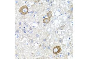 Immunohistochemistry of paraffin-embedded rat brain using NRG4 antibody (ABIN5971420) at dilution of 1/100 (40x lens). (Neuregulin 4 antibody)