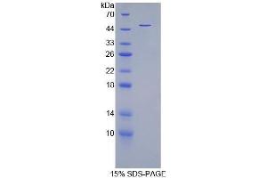 SDS-PAGE (SDS) image for Lipocalin 12 (LCN12) (AA 151-182), (AA 21-109) protein (His tag,GST tag) (ABIN2123176) (LCN12 Protein (AA 21-109, AA 151-182) (His tag,GST tag))