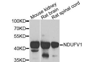 Western blot analysis of extracts of various cell lines, using NDUFV1 antibody. (NDUFV1 antibody  (AA 1-250))