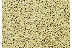 ABIN6277243 at 1/100 staining Mouse liver tissue by IHC-P. (PSMA1 antibody  (C-Term))