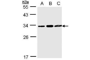 WB Image Sample(30 ug whole cell lysate) A:293T B:A431, C:MOLT4 , 12% SDS PAGE antibody diluted at 1:1000 (TATDN1 antibody  (Center))