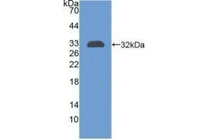 Detection of Recombinant CR1, Human using Polyclonal Antibody to Complement Receptor 1, Erythrocyte (CR1) (CD35 antibody  (AA 1780-2039))