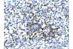 Image no. 1 for anti-REST Corepressor 3 (RCOR3) (N-Term) antibody (ABIN202657) (RCOR3 antibody  (N-Term))