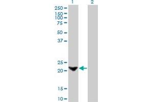 Western Blot analysis of TAGLN expression in transfected 293T cell line by TAGLN monoclonal antibody (M01), clone 1E2.