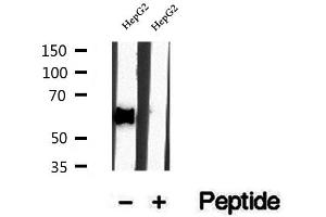 Western blot analysis of extracts of HepG2 cells, using DBR1 antibody. (DBR1 antibody)