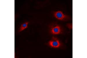 Immunofluorescent analysis of HECW2 staining in A549 cells. (HECW2 antibody  (Center))