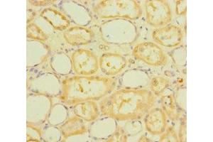 Immunohistochemistry of paraffin-embedded human kidney tissue using ABIN7168465 at dilution of 1:100 (RUFY4 antibody  (AA 174-473))