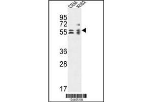 Western blot analysis in CEM,K562 cell line lysates (35ug/lane). (TBCE antibody  (AA 364-392))