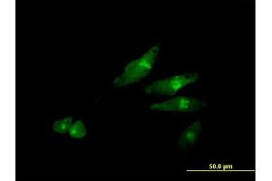 Immunofluorescence of purified MaxPab antibody to SCYL3 on HeLa cell. (SCYL3 antibody  (AA 1-688))