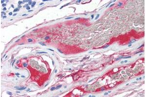 Human Small Intestine, Vessels (formalin-fixed, paraffin-embedded) stained with C2 antibody ABIN337358 at 10 ug/ml followed by biotinylated anti-mouse IgG secondary antibody ABIN481714, alkaline phosphatase-streptavidin and chromogen. (Complement C2 antibody)