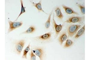 ICC testing of human HeLa cells with Nod1 antibody. (NOD1 antibody  (AA 1-160))