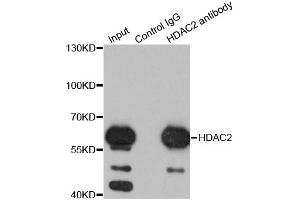 Immunoprecipitation analysis of 200ug extracts of K562 cells using 1ug HDAC2 antibody. (HDAC2 antibody)