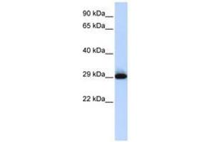 Image no. 1 for anti-Sushi Domain Containing 3 (SUSD3) (AA 35-84) antibody (ABIN6741328) (SUSD3 antibody  (AA 35-84))