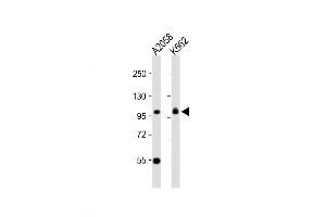 Western Blot at 1:1000 dilution Lane 1: A2058 whole cell lysate Lane 2: K562 whole cell lysate Lysates/proteins at 20 ug per lane. (COPG antibody  (C-Term))