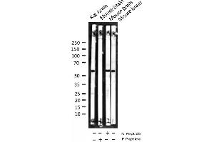 Western Blotting (WB) image for anti-SMAD, Mothers Against DPP Homolog 2 (SMAD2) (pSer467) antibody (ABIN6256347)
