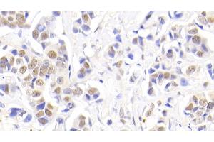 Immunohistochemistry (IHC) image for anti-Nucleophosmin (Nucleolar phosphoprotein B23, Numatrin) (NPM1) (AA 20-154) antibody (ABIN7435076)