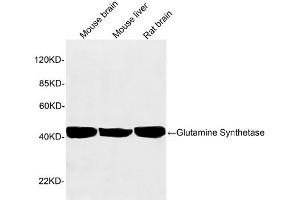 Western blot analysis of tissue lysates using 1 µg/mL Rabbit Anti-Glutamine Synthetase Polyclonal Antibody (ABIN398821) The signal was developed with IRDyeTM 800 Conjugated Goat Anti-Rabbit IgG. (GLN1 antibody  (AA 300-350))