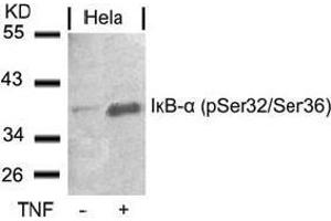 Image no. 3 for anti-Nuclear Factor of kappa Light Polypeptide Gene Enhancer in B-Cells Inhibitor, alpha (NFKBIA) (pSer32), (pSer36) antibody (ABIN196875)