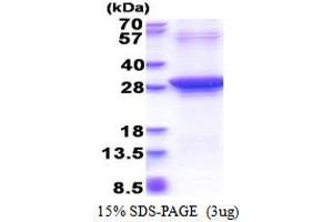 SDS-PAGE (SDS) image for RAD51 Homolog D (RAD51D) (AA 1-216), (Iso4) protein (His tag) (ABIN5853478)