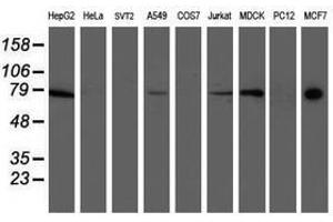 Image no. 10 for anti-Ribophorin 1 (RPN1) antibody (ABIN1500749)