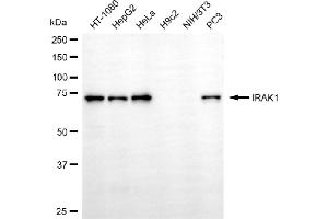 Western blotting analysis using IRAK1 antibody (ABIN7799112). (Recombinant IRAK1 antibody)